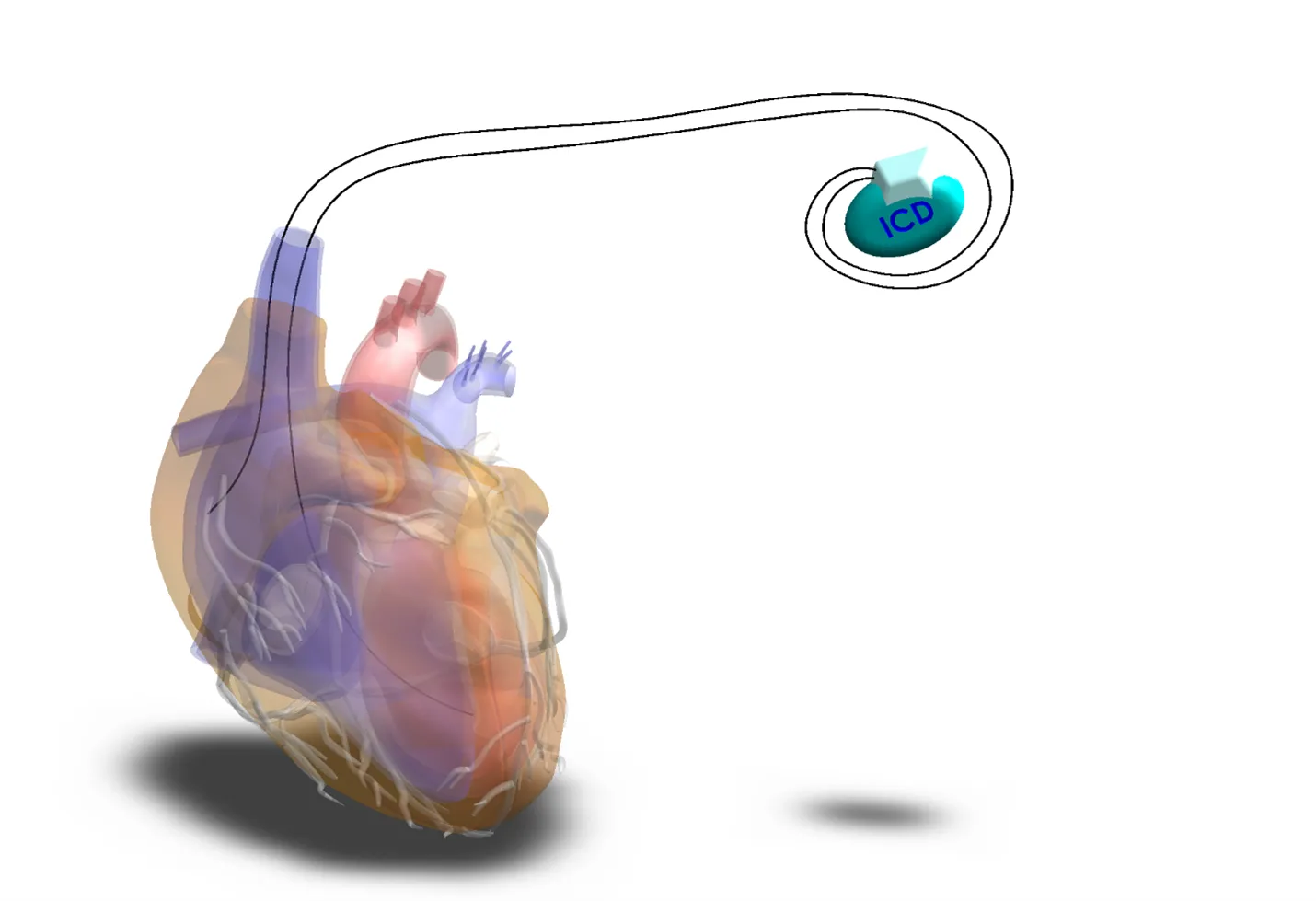 SCT Ceramics - advanced technical ceramics 