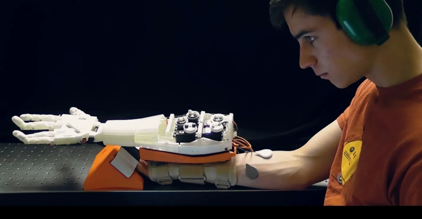 PSYONIC’s early prosthetic hand prototype 