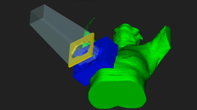 3D model of a human body and a medical device